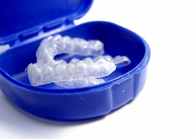 Dr. Cummiskey will create teeth whitening trays for you.