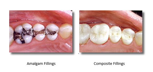 Before and after mercury-free filings
