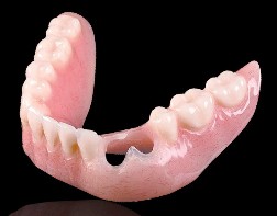 Cu-Sil Partial Denture